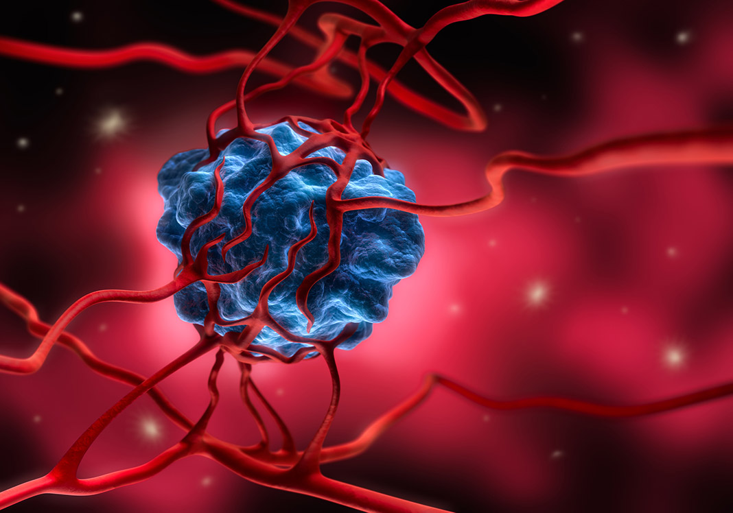 Cancer cell